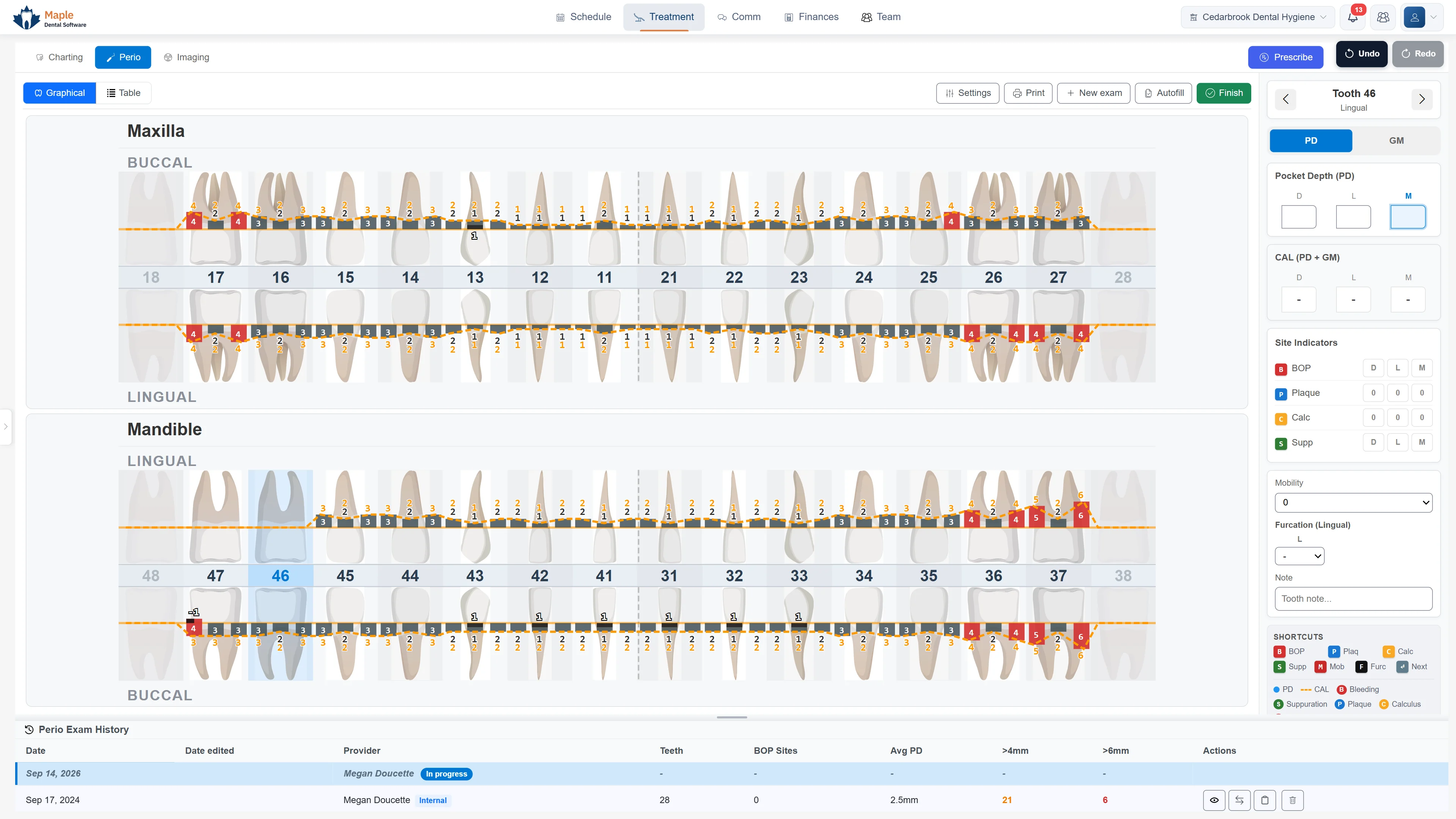 MapleDent Cloud perio chart: charted from the keyboard, then the comparison view shows each patient what improved and what got worse